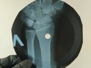 BEATLES SGT PEPPERS LONELY  X-Ray USSR Record Roentgen Bones Ribs Music Vinyl
