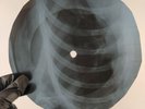 ROLLING STONES SATISFACTION X-Ray USSR Record Roentgen Bones Ribs Music Vinyl