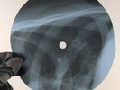 BEATLES ANY TIME AT ALL X-Ray USSR Record Roentgen Bones Ribs Music Vinyl