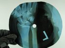 BEATLES THERE IS A PLACE X-Ray USSR Record Roentgen Bones Ribs Music Vinyl