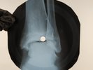 DAVID ROSE THE STRIPPER X-Ray USSR Record Roentgen Bones Ribs Music Vinyl