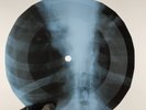 LED ZEPPELIN MOBY DICK X-Ray USSR Record Roentgen Bones Ribs Music Vinyl