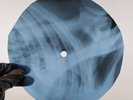 PINK FLOYD CHAPTER 24 X-Ray USSR Record Roentgen Bones Ribs Music Vinyl