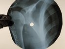 BLACK SABBATH RAT SALAD X-Ray USSR Record Roentgen Bones Ribs Music Vinyl