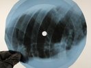 SINATRA BLAME IT ON X-Ray USSR Record Roentgen Bones Ribs Music Vinyl
