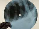 CHORDETTES LOLLIPOP X-Ray USSR Record Roentgen Bones Ribs Music Vinyl