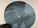 PINK FLOYD NARROW WAY P3 X-Ray USSR Record Roentgen Bones Ribs Music Vinyl