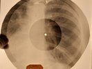 David Bowie - Changes X-RAY USSR BONES RECORDS 428