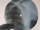 NINA SIMONE  LITTLE GIRL BLUE X-Ray USSR Record Roentgen Bones Ribs Music Vinyl
