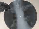 NINA SIMONE SINNERMAN X-Ray USSR Record Roentgen Bones Ribs Music Vinyl