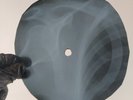 BEATLES CANT BUY ME LOVE X-Ray USSR Record Roentgen Bones Ribs Music Vinyl