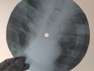 BEATLES WHEN I'M SIXTY FOR X-Ray USSR Record Roentgen Bones Ribs Music Vinyl