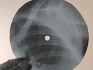BEATLES WAIT X-Ray USSR Record Roentgen Bones Ribs Music Vinyl