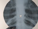 PINK FLOYD ASTRONOMY DOMINO X-Ray USSR Record Roentgen Bones Ribs Music Vinyl