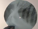 BOB DYLAN ABSOLUTELY SWEET MAR X-Ray USSR Record Roentgen Bones Ribs Music Vinyl