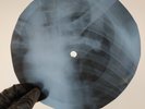 BEATLES WITHIN YOU WITHOUT X-Ray USSR Record Roentgen Bones Ribs Music Vinyl