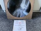 KASABIAN The Alchemist’s Euphoria Vinyl Bones Picture Disc ONLY 2000 MADE *RARE*