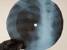 PINK FLOYD MOTILDA MOTHER X-Ray USSR Record Roentgen Bones Ribs Music Vinyl