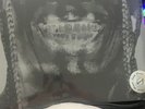 travis scott utopia vinyl cover 5