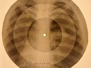 USSR X-RAY ROENTGEN BONES RECORD ORIGINAL OLD RIBS 445