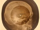 USSR X-RAY SKULL ROENTGEN BONES RECORD ORIGINAL OLD RIBS 450