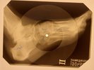 USSR X-RAY ROENTGEN BONES RECORD ORIGINAL OLD RIBS 469