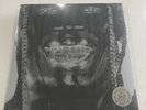 Travis Scott Utopia 2 Disk Vinyl LP Cover #5 - Factory Sealed
