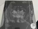 Travis Scott Utopia 2 Disk Vinyl LP Cover 5