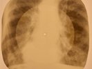 X-RAY USSR  ROENTGEN BONES RECORD ORIGINAL OLD RIBS 470