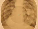 USSR X-RAY  ROENTGEN BONES RECORD ORIGINAL OLD RIBS 483
