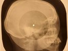 X-RAY SKULL USSR ROENTGEN BONES RECORD ORIGINAL OLD RIBS 490