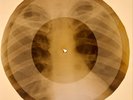 USSR X-RAY ROENTGEN BONES RECORD ORIGINAL OLD RIBS 486