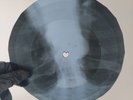 OS MUTANTES MINHA MENINA X-Ray USSR Record Roentgen Bones Ribs Music Vinyl