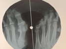 FRANK SINATRA MY WAY X-Ray USSR Record Roentgen Bones Ribs Music Vinyl