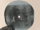 ELVIS TUTTI FRUTTI X-Ray USSR Record Roentgen Bones Ribs Music Vinyl