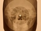 USSR X-RAY SKULL ROENTGEN BONES RECORD ORIGINAL OLD RIBS 467