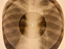 X-RAY USSR  ROENTGEN BONES RECORD ORIGINAL OLD RIBS 510
