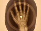 X-RAY USSR HAND ROENTGEN BONES RECORD ORIGINAL OLD RIBS 444