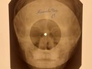 X-RAY SKULL USSR ROENTGEN BONES RECORD ORIGINAL OLD RIBS 472