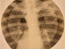 X-RAY USSR  ROENTGEN BONES RECORD ORIGINAL OLD RIBS 509