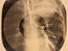 X-RAY USSR  ROENTGEN BONES RECORD ORIGINAL OLD RIBS 512