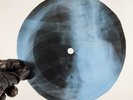 PINK FLOYD BIKE X-Ray USSR Record Roentgen Bones Ribs Music Vinyl