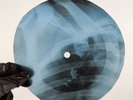 DAVID BOWIE WHEN I LEAVE MY DR X-Ray USSR Record Roentgen Bones Ribs Music Vinyl