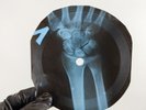 CHORDETTES LOLLIPOP X-Ray USSR Record Roentgen Bones Ribs Music Vinyl