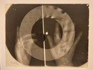 X-RAY HANDS USSR  ROENTGEN BONES RECORD ORIGINAL OLD RIBS 516