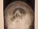 X-RAY SKULL USSR ROENTGEN BONES RECORD ORIGINAL OLD RIBS 518