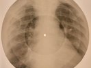 X-RAY USSR  ROENTGEN BONES RECORD ORIGINAL OLD RIBS 533