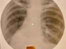 X-RAY USSR  ROENTGEN BONES RECORD ORIGINAL OLD RIBS 543