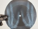 PINK FLOYD ASTRONOMY DOMINO X-Ray USSR Record Roentgen Bones Ribs Music Vinyl