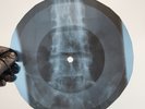 PINK FLOYD SUMMER 68 X-Ray USSR Record Roentgen Bones Ribs Music Vinyl